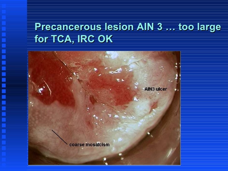 ain anal condition Red spots on my penis head